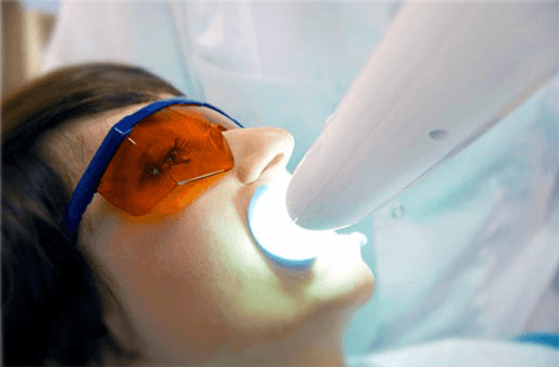Understanding the Causes of Teeth Sensitivity Kingswood