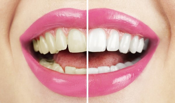 What Early Signs of Oral Cancer Should You Never Ignore Kingswood?