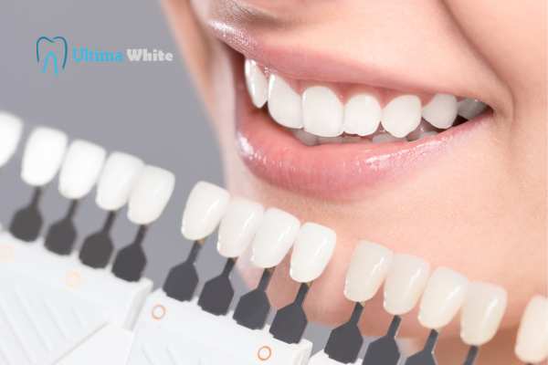How to Maximise the Results of Your Laser Teeth Whitening Treatment Kingswood
