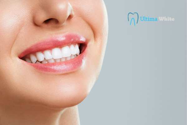 How Long Do Dental Crowns Last and How Can You Maintain Them Kingswood?