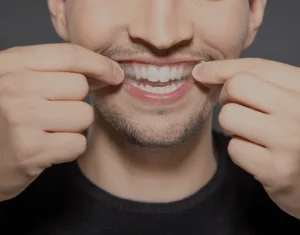 Overview of Home Teeth Whitening Kits Kingswood