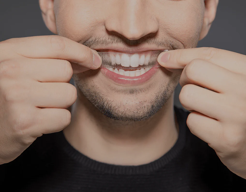 How Are Invisible Aligners Changing Orthodontic Treatments Kingswood?