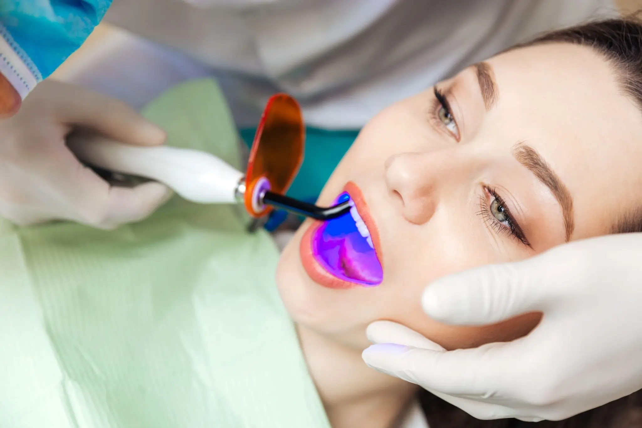 Common Risks of Whitening Without Expert Dental Guidance Kingswood