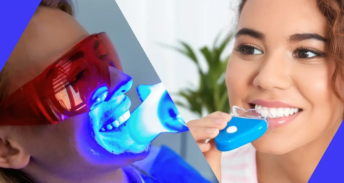 Expert Tips for Safe and Effective Whitening Kingswood