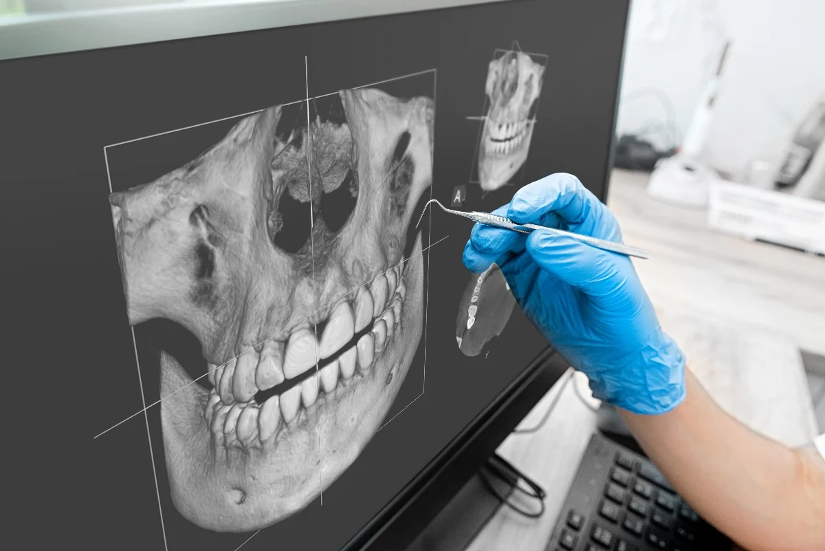 Key Benefits of 3D Printing for Patients and Dentists Kingswood