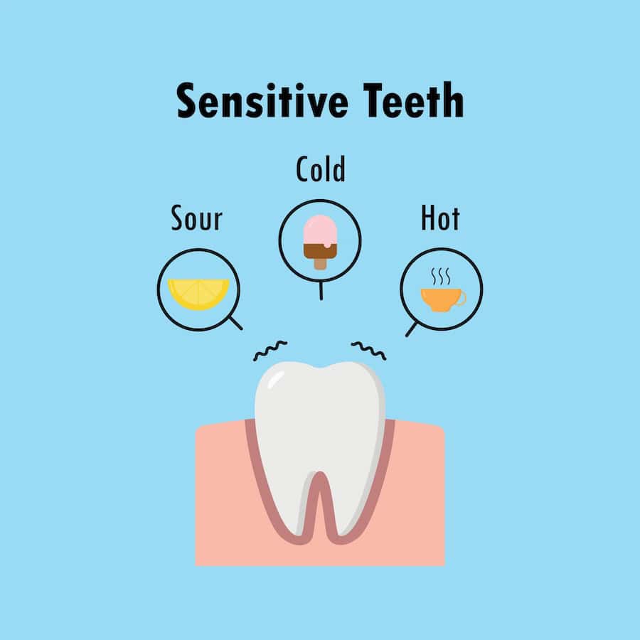 Why Do Teeth Become Sensitive After Whitening Treatments Kingswood?