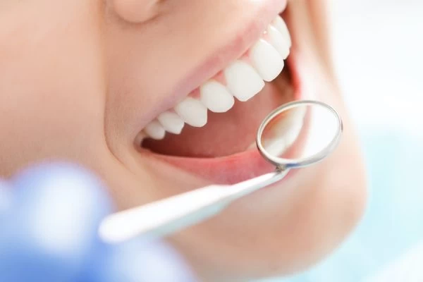 What Are the Best Foods to Eat After Teeth Whitening Kingswood?