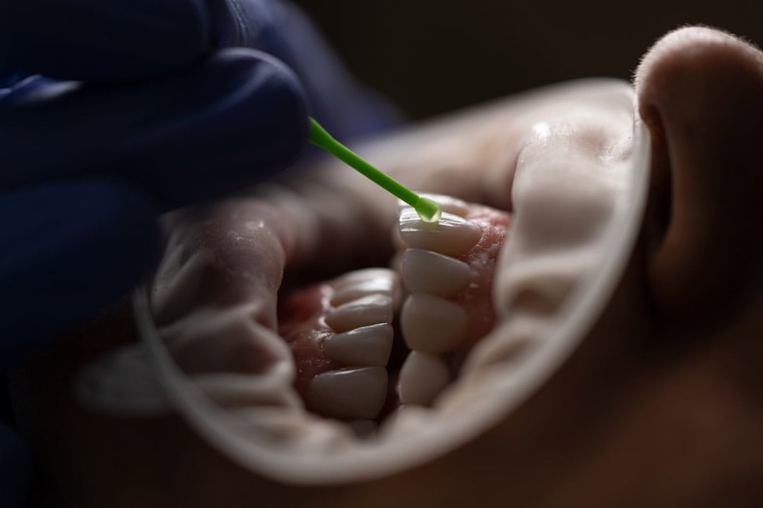 How Saliva Protects Your Teeth and Gums Kingswood