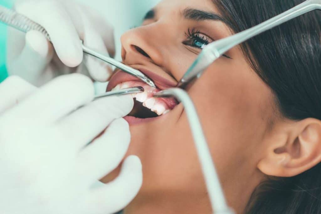 Braces Are Just for Kids – Myth or Reality Kingswood