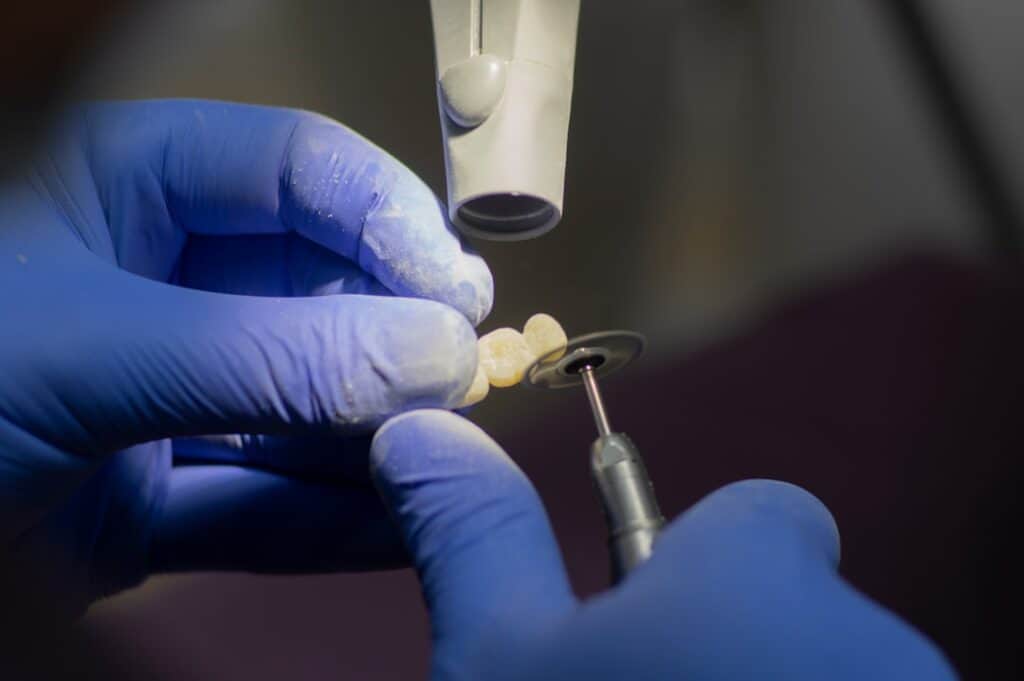 Customised Dental Solutions: Crowns, Aligners, and Implants Kingswood