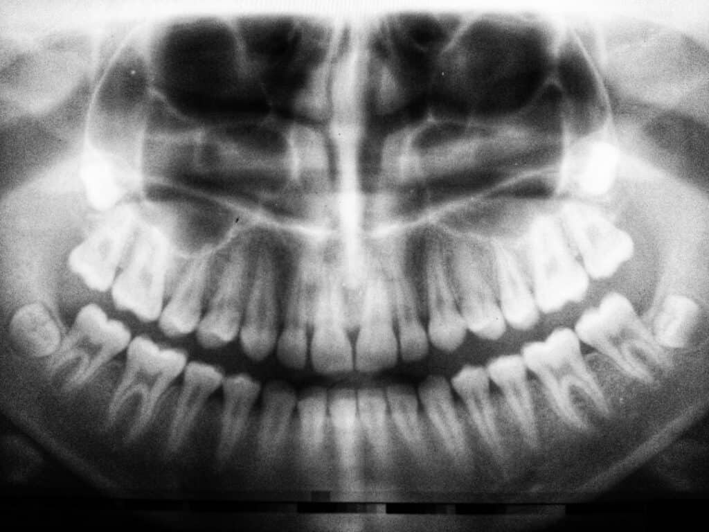 The Future of 3D Printing in Oral Healthcare Kingswood
