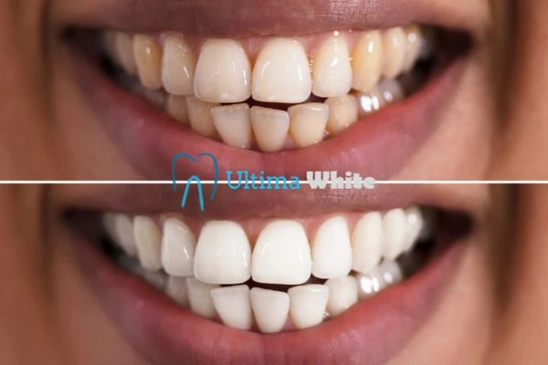 Long lasting results from Ultima White Kingswood